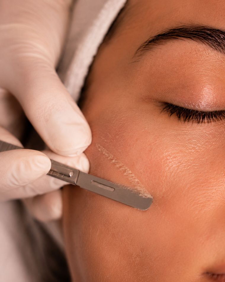Dermaplaning