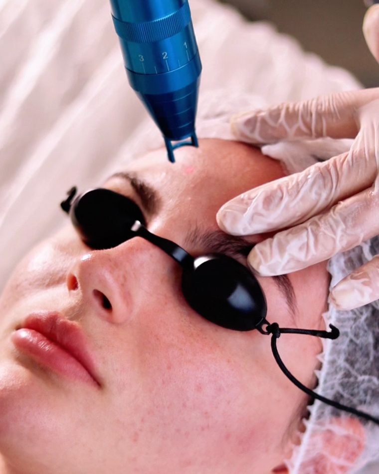 Rejuvenescimento e Manchas
